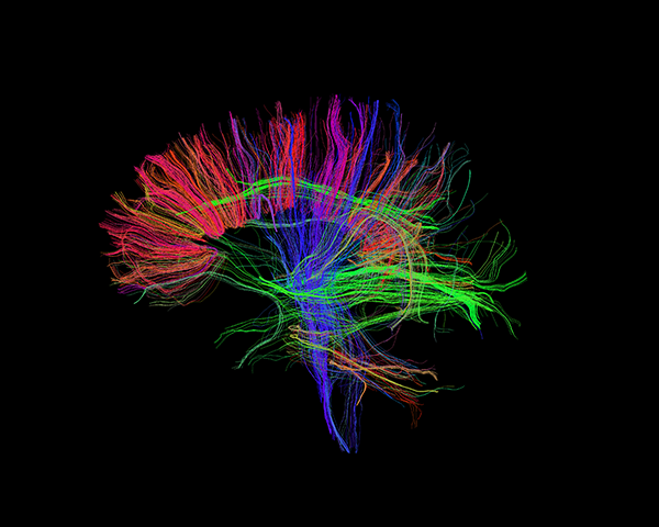 Mapping of Human Brain Connectivity Using MRI
